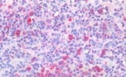 ABCA7 Antibody, Novus Biologicals 50 &mu;g; Unconjugated:Antibodies, Polyclonal